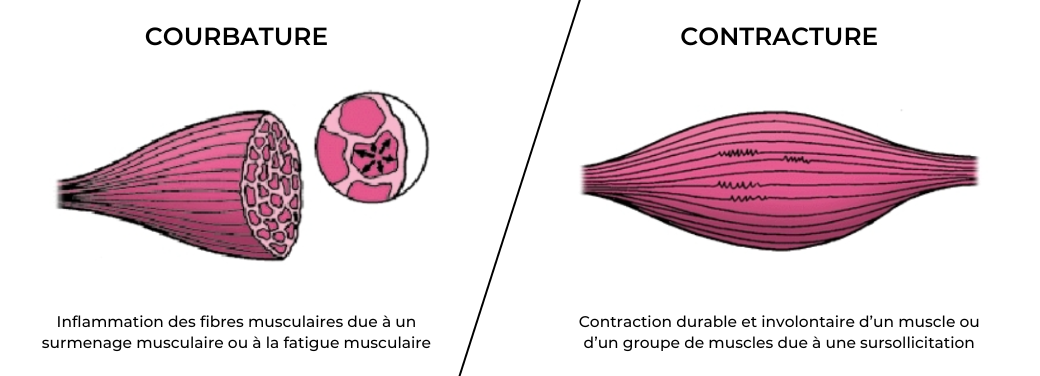 CourbaturesVSContractures