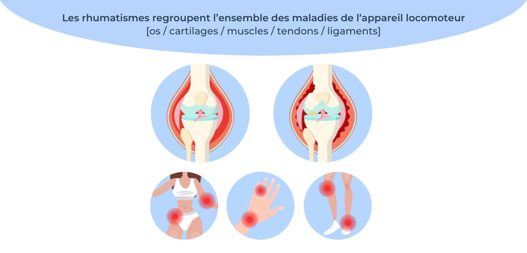 Infographie rhumatismes