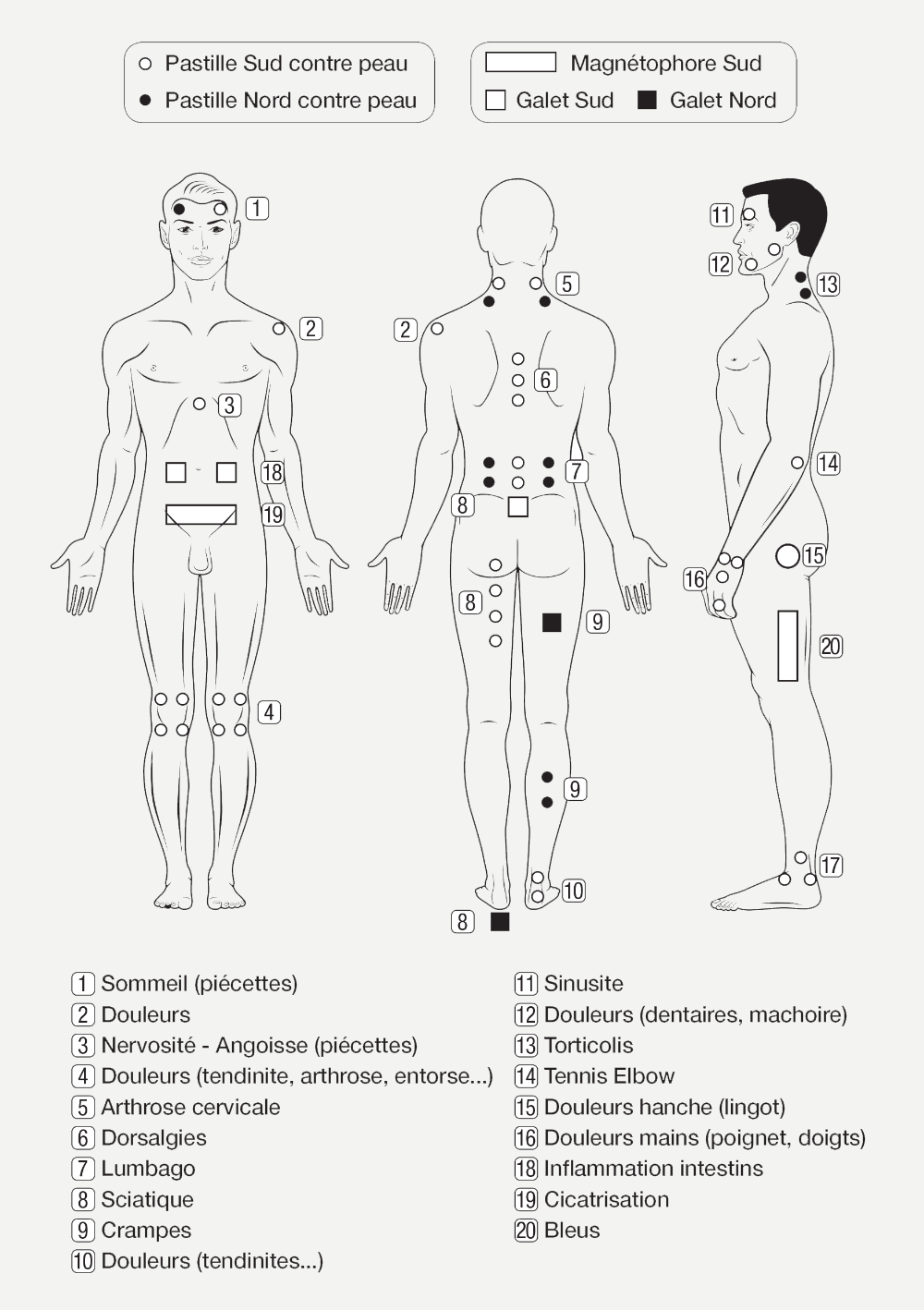 schéma du placement des aimants de magnétothérapie