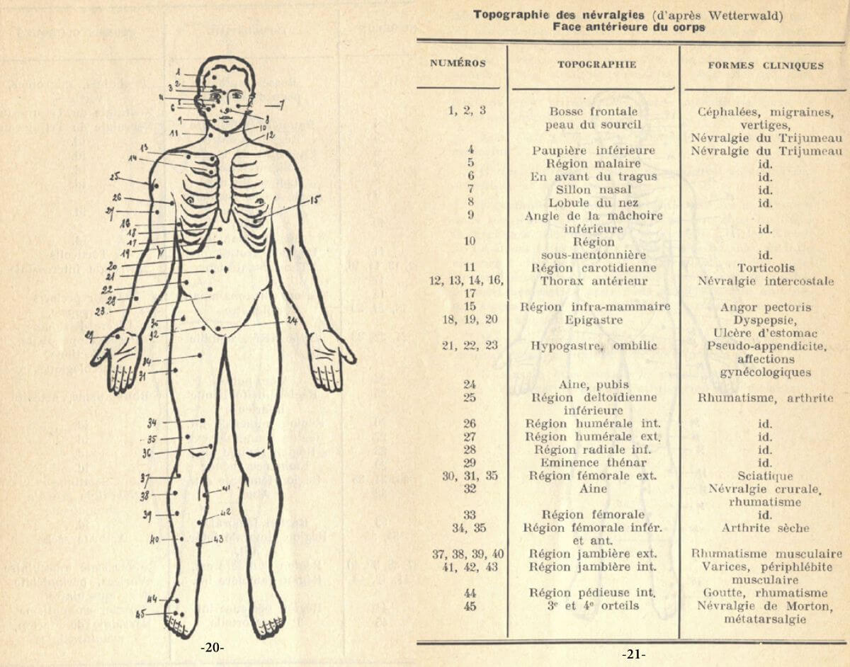 correspondance des névralgies antérieures