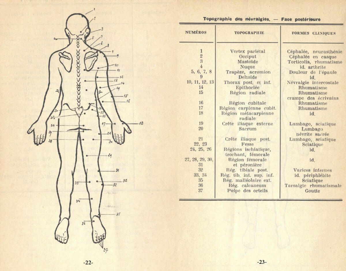 correspondance des névralgies postérieures